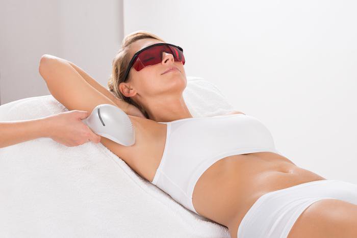 Start Laser Hair Removal Now